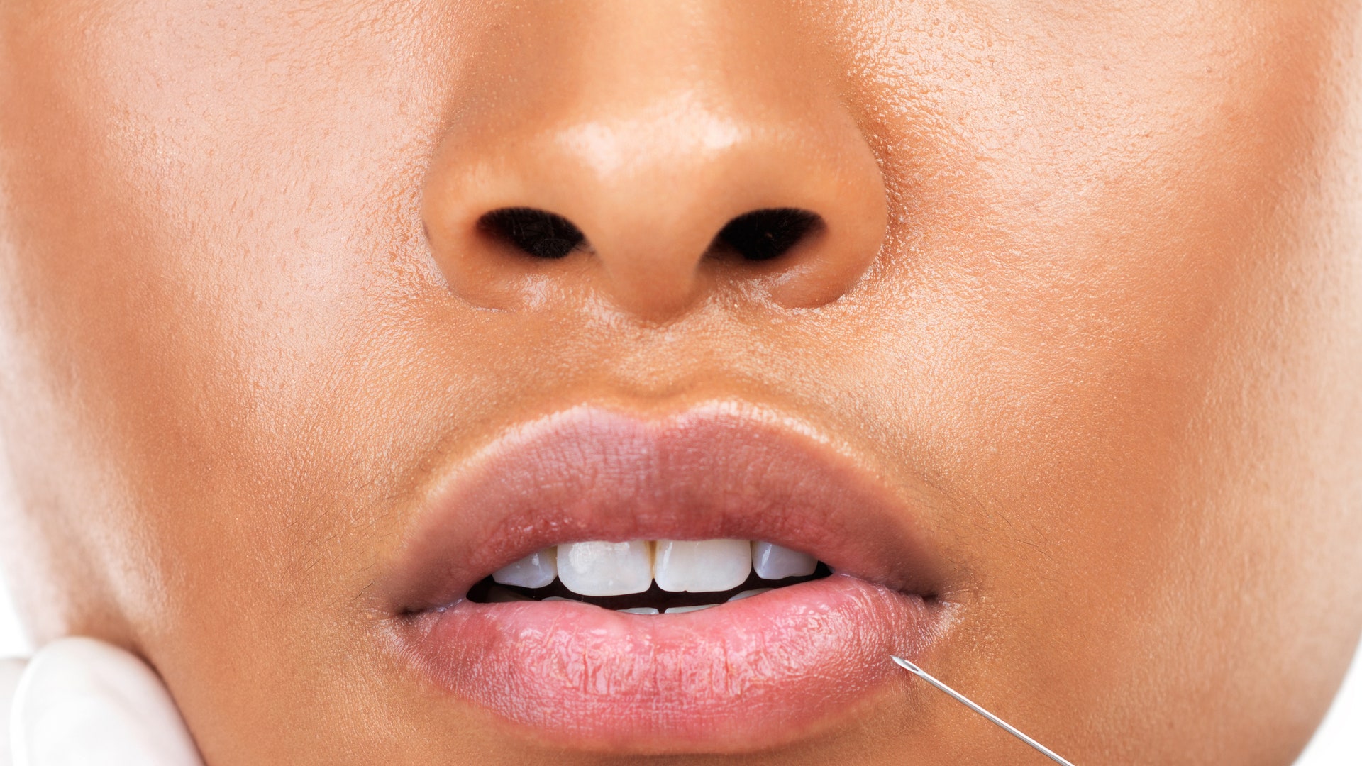 Dermal Fillers That Already Have Your Body’s Approval